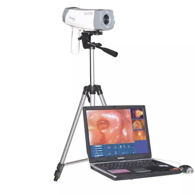 1/4‘’ Color CCD Medical Digital Video Electronic Colposcope Camera 800000+Tripod