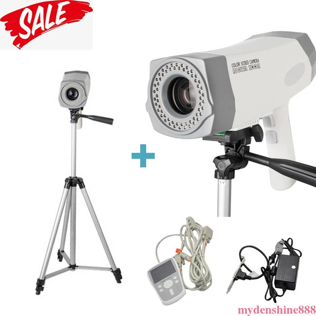 Electronic Colposcope Video SONY Camera 800K pixel LED Screen Handle+Tripod