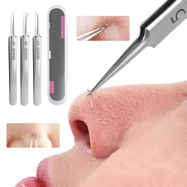 Cell Clip Tools Acne Needle Set Acier Inoxydable Acne Clip Blackhead Needle R