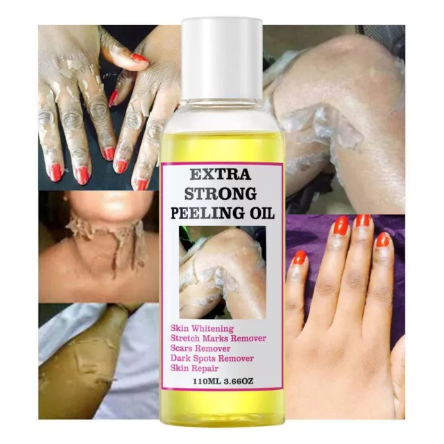 Extra Strong Yellow Peeling Oil Dark Skin Body Exfoliating Bleaching Brightening