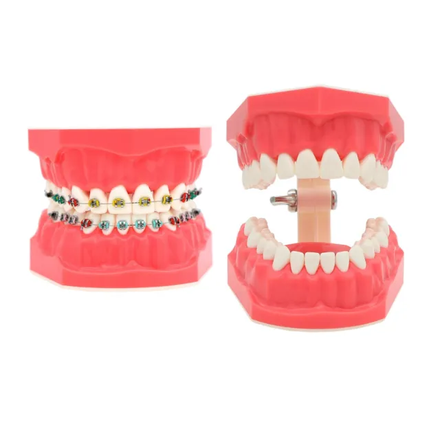 Dental Typodont Orthodontic Teeth Model with Metal Braces for Brushing Practice