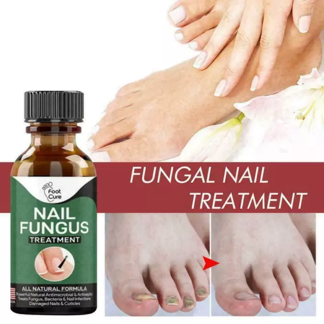 30ml Nail Fungus Treatment Best Nail Repair Effective Neu D2D8 D8E0 NEU.