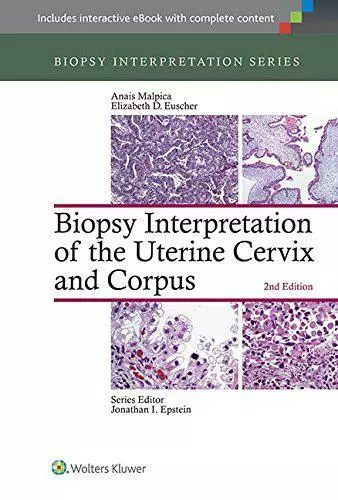 Biopsie Interpretation Of The Utérin Cervix Et Corpus (Biopsie Interprétation Se