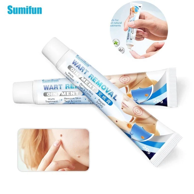 ORIGINAL WARTS REMOVER Cream Skin Tag Remove Plantar Corn Callus