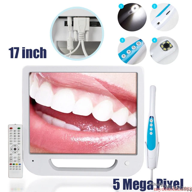 Dental Intraoral Intra Oral Camera 5MP 6LED High Resolution 17" Digital Monitor