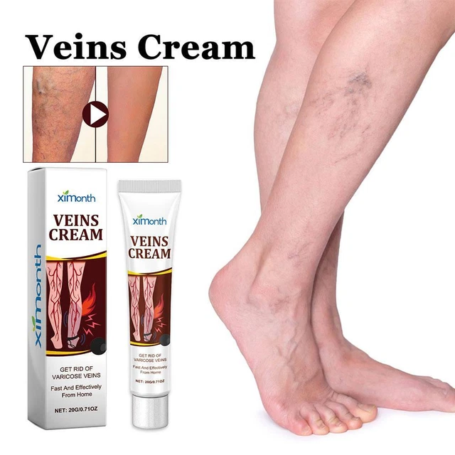 Trendy crema per vene varicose, selezione stupenda