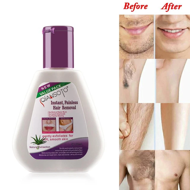 Entfernungscreme schmerzlos enthaarungshemmend Haarwuchshemmer Aloe natürliche Extraktion