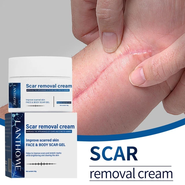 Crema rimozione macchie cicatrici acne tagli ustioni stretchingstr F5P9