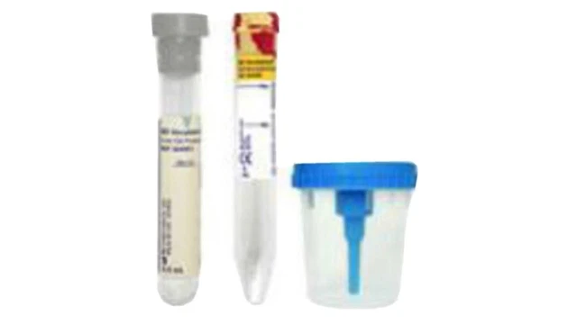CASE OF 50 BD VACUTAINER Urine collection cup kit 364956 exp 7-31-2024