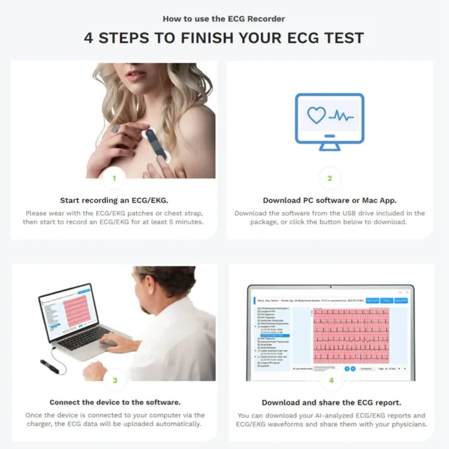 Monitor ECG 24 horas con informes profesionales de análisis de AI-ECG en el PC 2