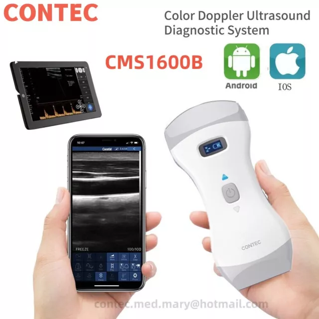 Color Ultrasound 3 in1 Sonda Convessa, Sonda Lineare Android,Wifi Wireless CE