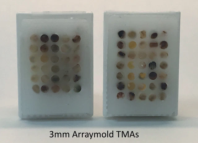 TMA Arraymold Tissue Microarray 3mm 35 Core Pathology Histology Research Inst.
