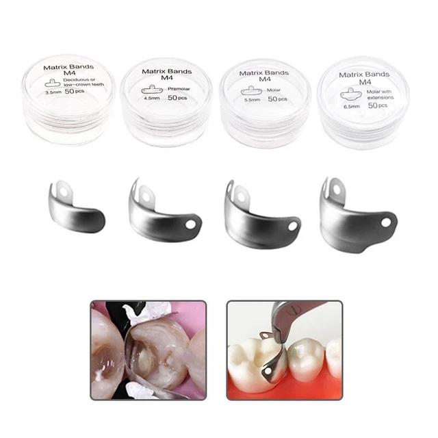 50PCS Dental Sectional Contoured Matrices Matrix Bands for Restorations