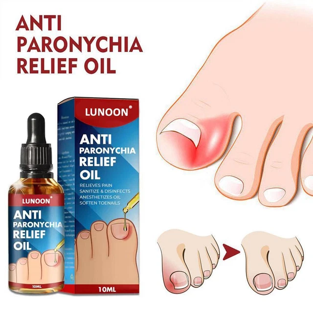 10 ml de aceite en relieve para ranuras de uñas encarnadas, aceite de cuidado gris suave para el eliminación