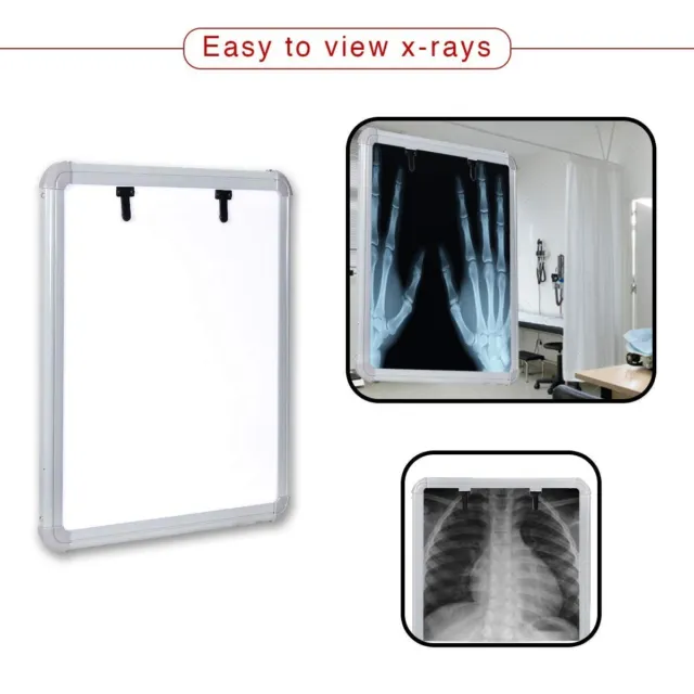 LED X-Ray View Box with Automatic Film Activation and Variable Bright