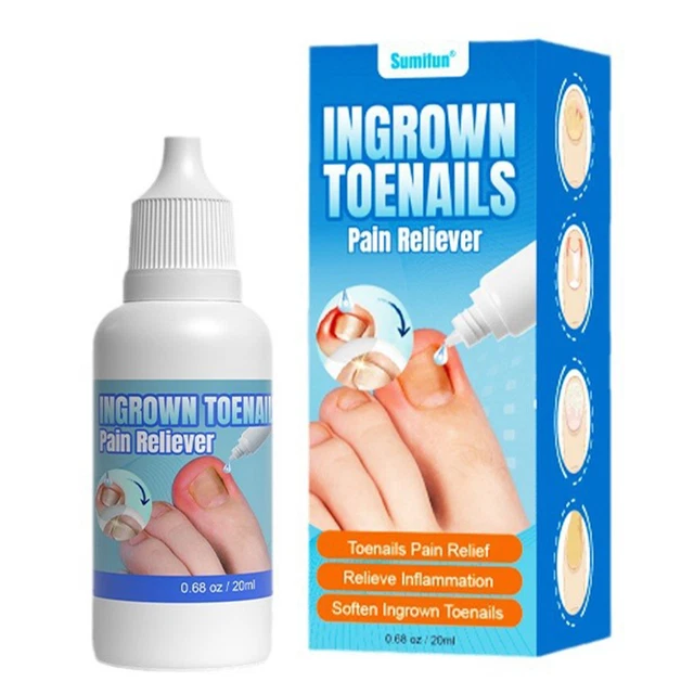 INGROWN TOENAIL DROPS Endogenous Toe Nail Repair Essence Serum Nail