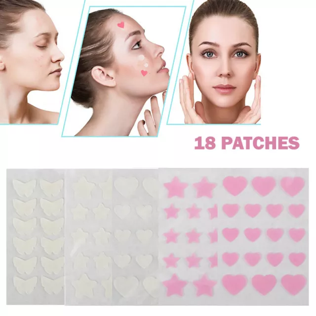 18 piezas pegatinas de belleza para tratamiento de granos con parches para acné manchas invisibles y
