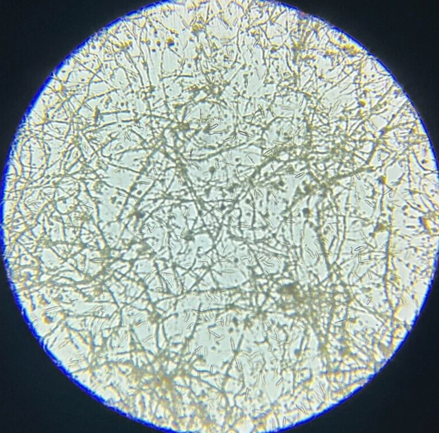 19th c J.D. Moller Microscope Slide Diatom Holstein Ger. Achnanthes Subsessilis