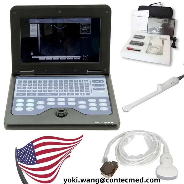 10.1 inch Ultrasound Scanner Portable Laptop Machine Digital Abdominal Machine
