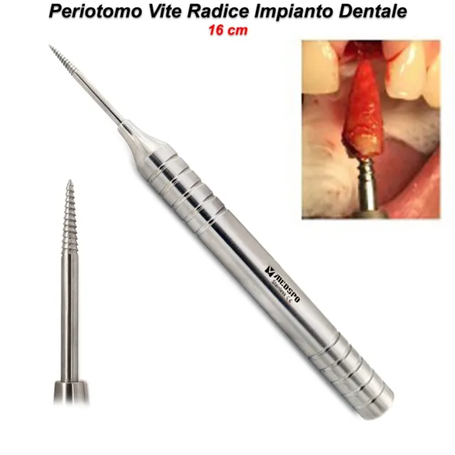 Periotomo Vite Radice Chirurgia Implantare Dentale Estrazione Atraumatica Dente