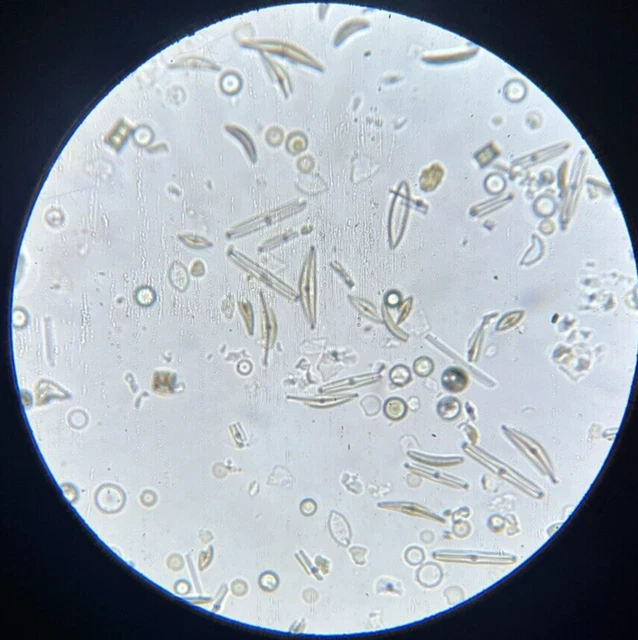 J.D. Moller Microscope Slide Diatom Lutzelburg Germany Gold Medal 1869