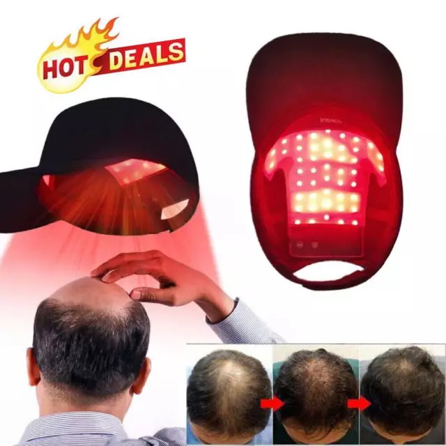 Laser&LED Red Light Therapy Cap Hair Growth Fast Regrowth Anti Hair Loss hat~