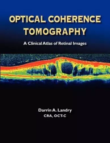 Darrin A Landry Optical Coherence Tomography a Clinical Atlas of Retinal (Poche)