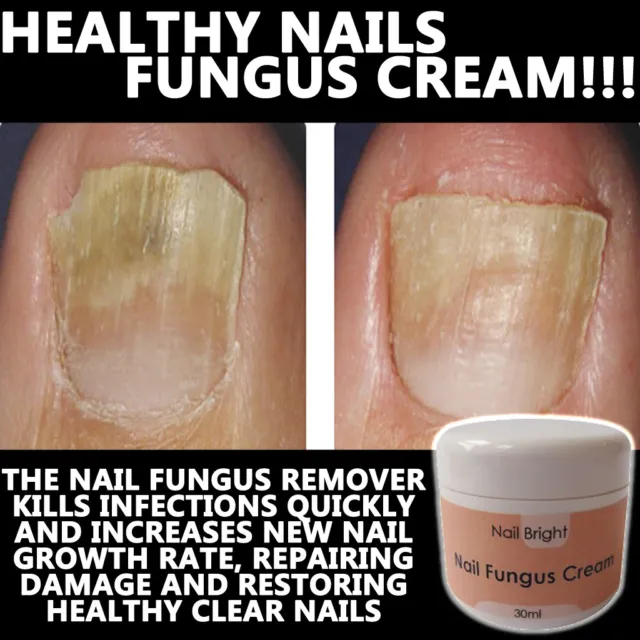 Nail Bright Nail Fungus Cream Lotion Stops Brittle Broken Nails Anti Fungal