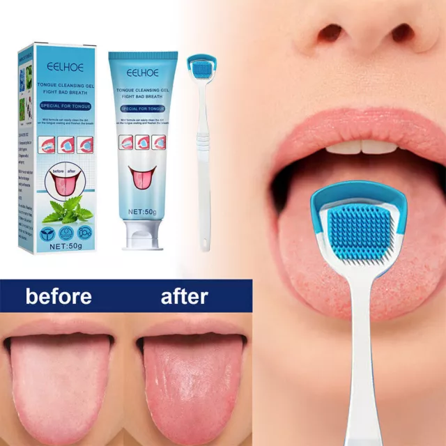 Tongue Cleaning Gel with Tung Scraper Brush Fresh Breath Kit Clean Set AU