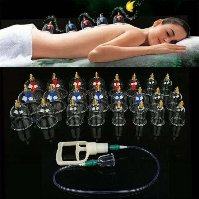 32tlg Schröpfen Set für Vakuum Massage mit Schröpfgläser Rohr Cupping Schröpfset