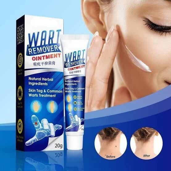 20gr Wart Skin Tag & Common Warts remover cream removes moles & warts original