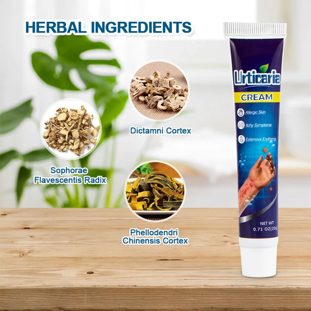 Urticaria crema antiprurítica 20 g ungüento natural a base de hierbas antipicazón CHU
