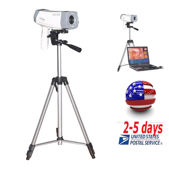Digital Video Electronic Colposcope 480,000 Camera +Software+Tripod US FDA