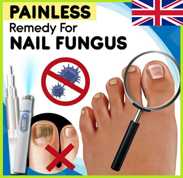Signs and Symptoms of Toenail Fungus