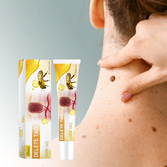 Crema de veneno de abeja FLhrweasw 60g crema hidratante tratamiento de verrugas y lunares suave | Bodega Aurrera en línea Crema de veneno de abeja FLhrweasw 60g crema hidratante tratamiento de verrugas y lunares suave | Bodega Aurrera en línea