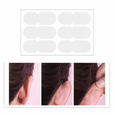 Elf Ear Stickers Veneer Ears Become Ear Correction Vertical Stand Ear Stick-AZ