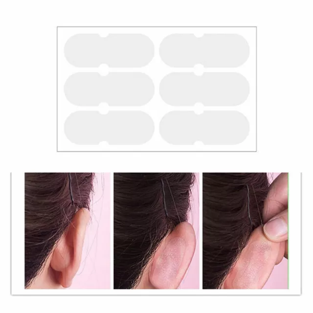 Elf Ear Stickers Veneer Ears Become Ear Correction Vertical Stand Ear Stick-NZ