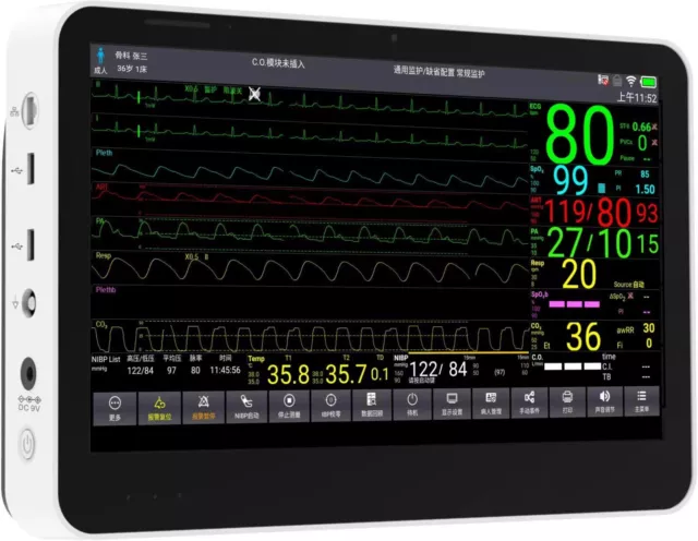 CONTEC CMS8500 Paitnet Monitor Touch 14 Inch Vital Signs Monitor 6 Parameters 3