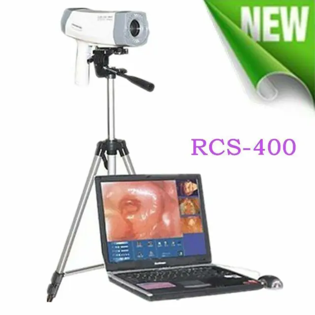 High Resolution Vaginal Colposcope + Software  Tripod - Medical Digital Imaging