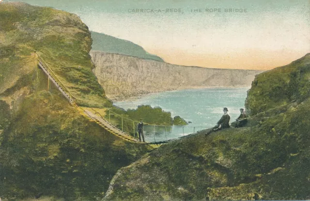 ANTRIM - Carrick-A-Rede The Rope Bridge - Northern Ireland Postcard