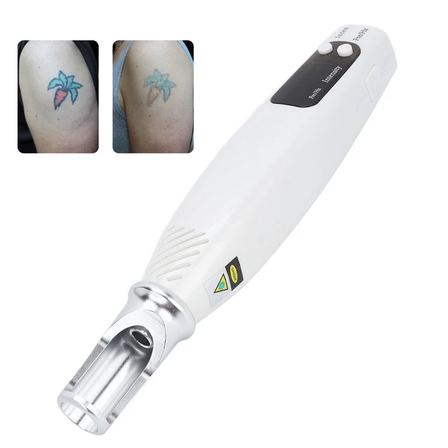 (EU Plug) Handheld-Picosecond-Stift Blaues Licht Tattoo Freckle Dark Spot R TOS