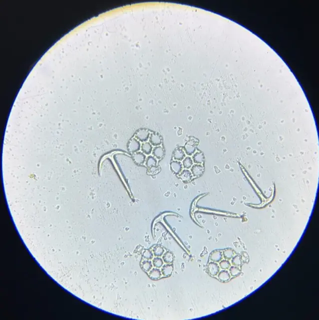 J.D. Moller Microscope Slide Sea Cucumber Synapta Gladbra S. Phillipines