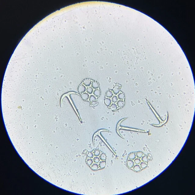 J.D. Moller Microscope Slide Sea Cucumber Synapta Gladbra S. Phillipines