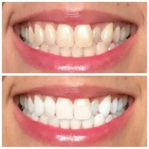 100% Original NU SKIN AP 24 Teeth Whitening Fluoride Toothpaste 110g (NEW LOOK) 2