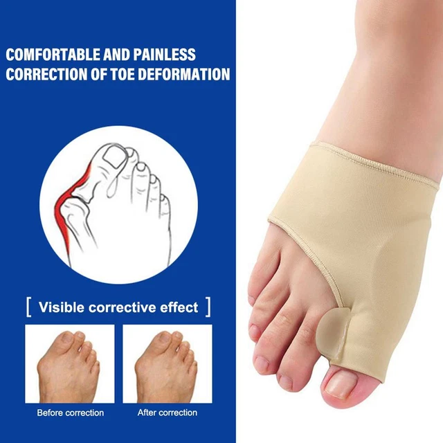 2Pcs Big Toe Bunion Corrector Straightener Bunion Pad Protect Fabric Gel D5C0