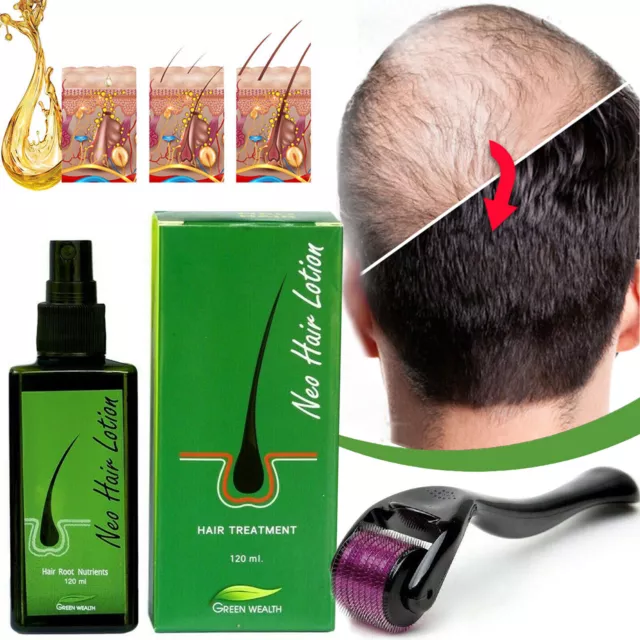 NEO Hair Regrowth Lotion Haarpflege / Öl gegen Haarausfall/ & 1 Derma Roller