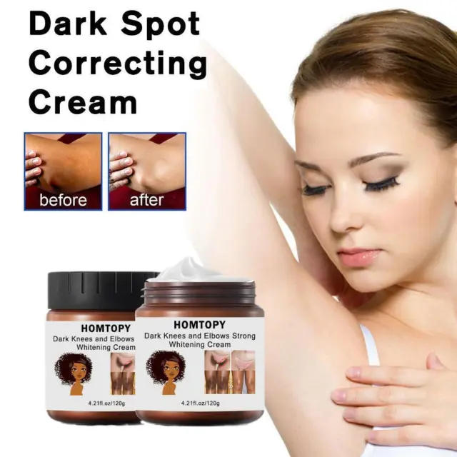 Dark Spot Remover Cream ​Freckle Cream Hyperpigmentation Melasma Skin  Whitening