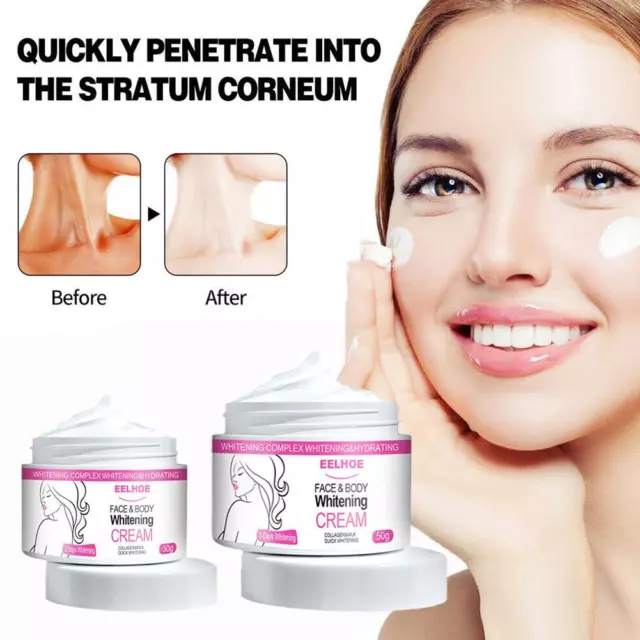 "Crema blanqueadora de la piel para aclarar la cara eliminación de manchas oscuras blanqueamiento corporal"