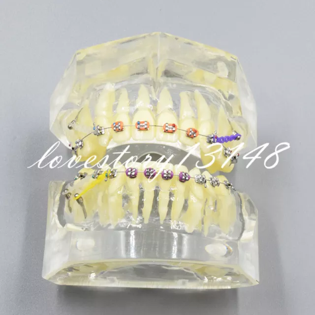 Dental Transparent Orthodontics Treatment Model Teeth Study/Teach Model #3005 02