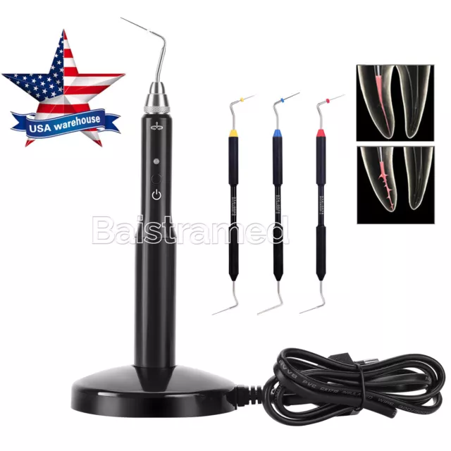 Dental Gutta Percha Obturation Endo Heated Pen/ Buchanan Hand Plugger Tips